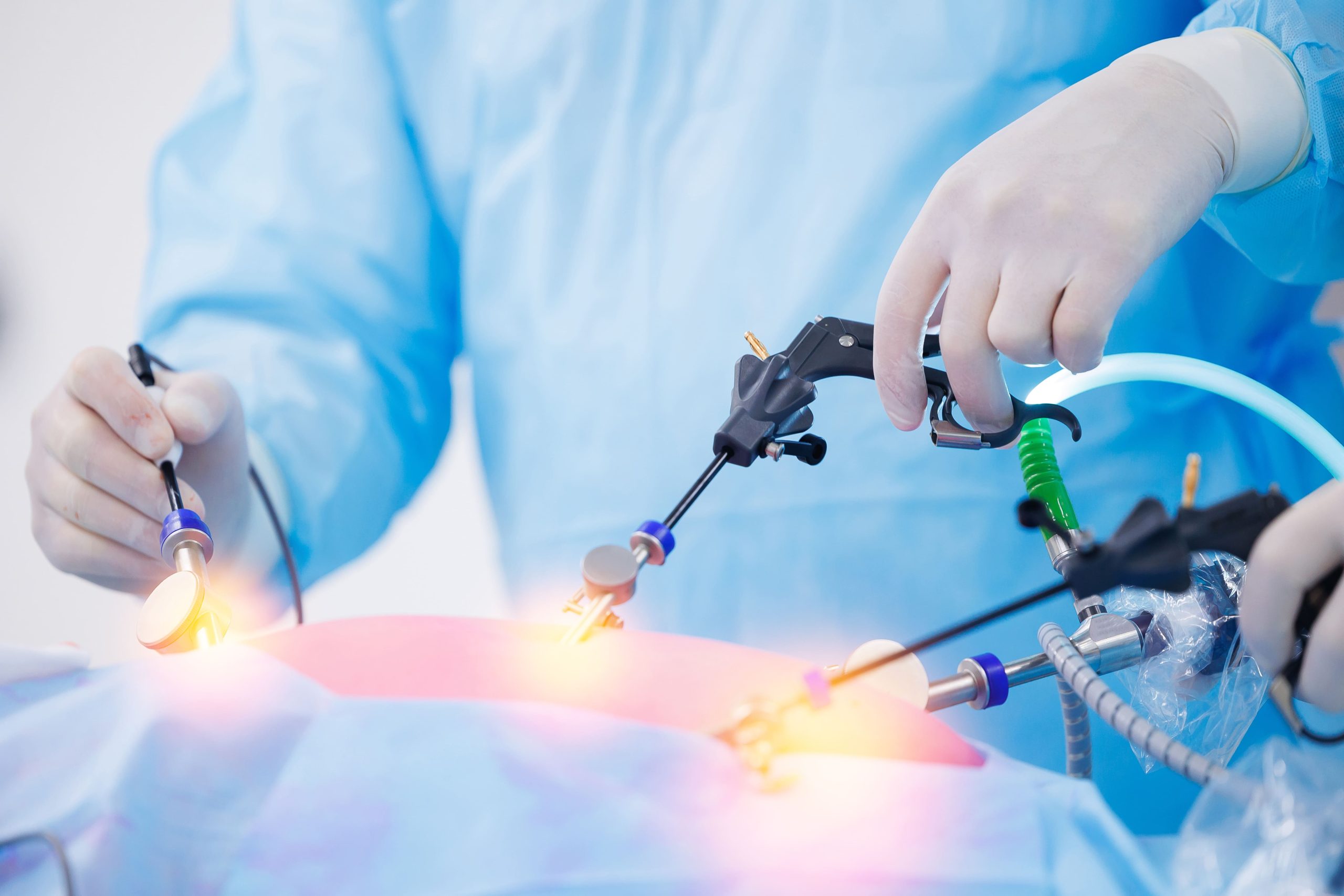 Diferença entre cirurgia robótica e laparoscópica