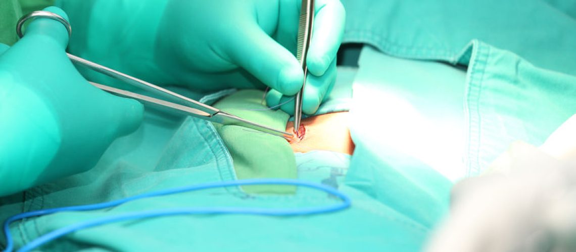 cirurgia de hérnia epigástrica