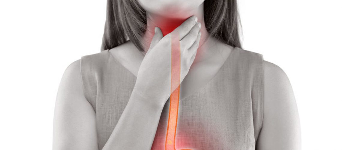 refluxo gastroesofágico