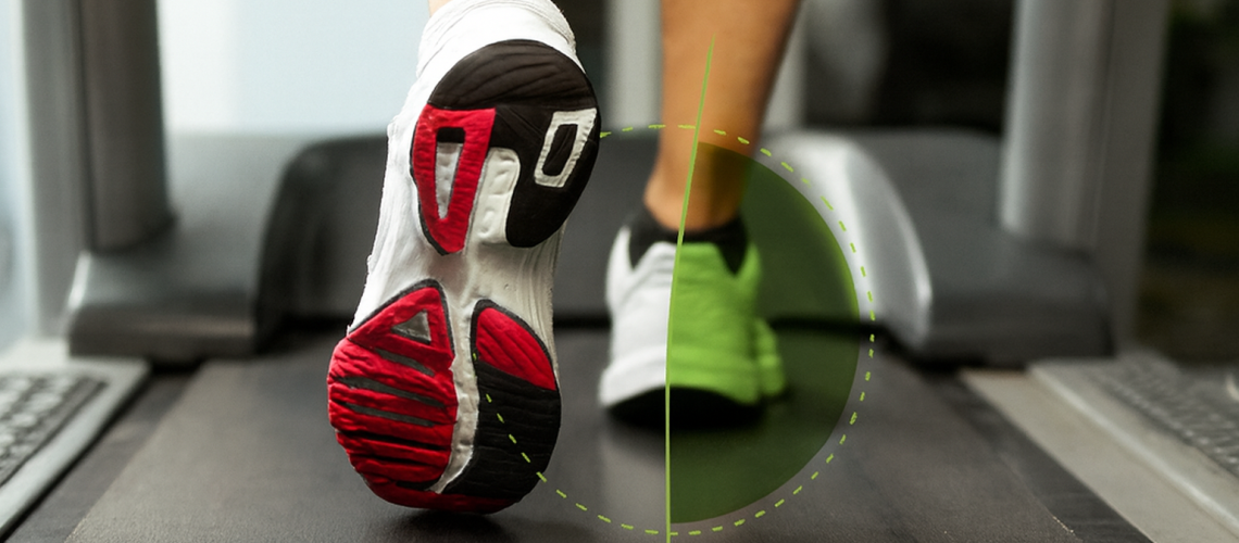 A Importância da Avaliação Biomecânica da Parede Abdominal no Pré-Operatório de Hérnias_ Benefícios e Métodos