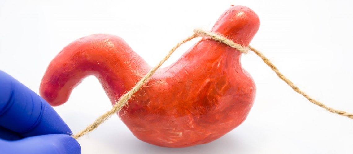 Cirurgia bariátrica