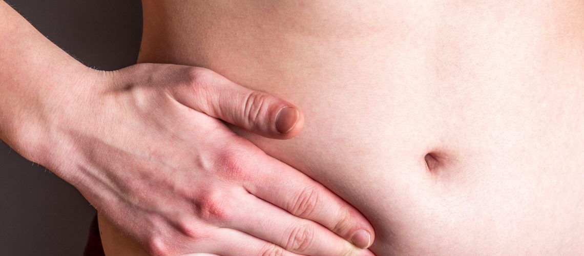 hérnias recorrentes