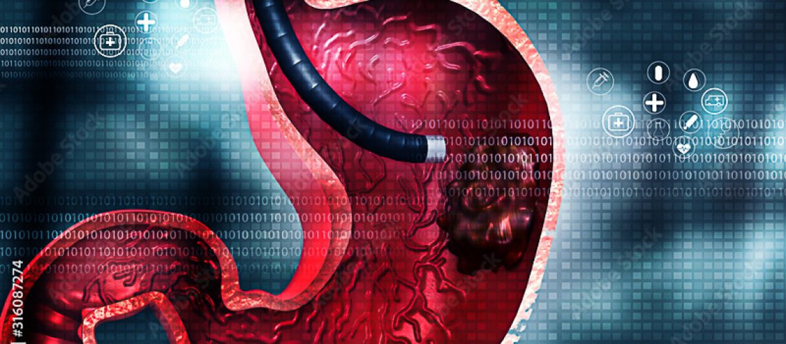 o que é o exame de endoscopia e qual a sua finalidade