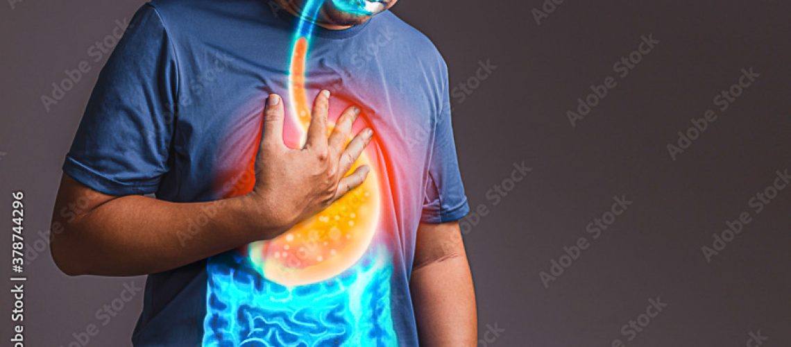 refluxo o que é e qual seu tratamento