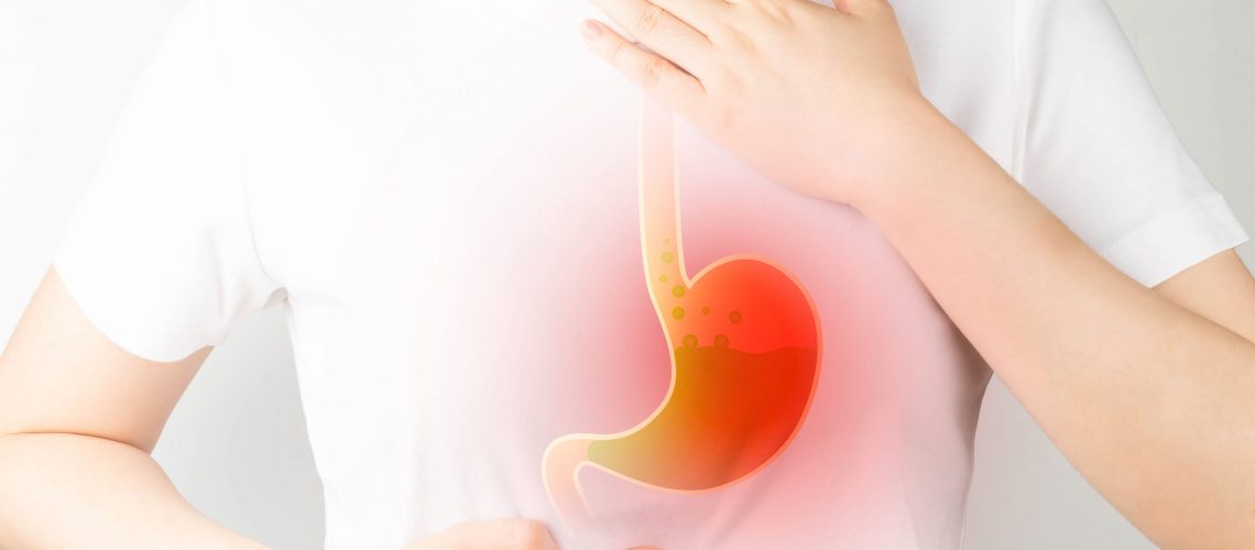 Refluxo Gastroesofágico