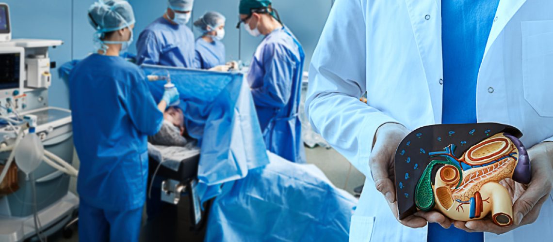 Liver resection, gallbladder and pancreas surgery. Hospital operating theater with surgery team while surgical operation of human internal organs, liver, gallbladder, pancreas