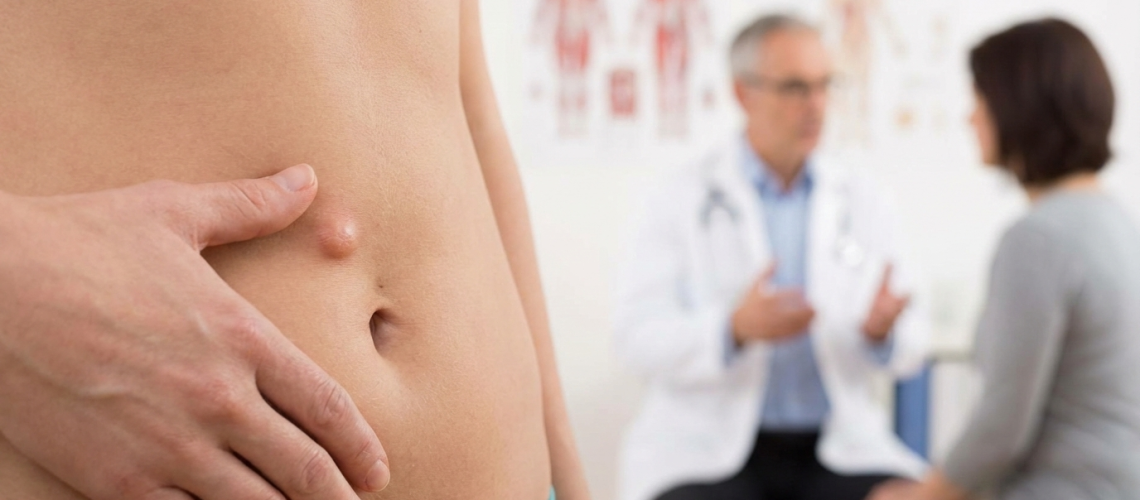 Dor e _caroço_ na barriga além das hérnias, quais são as possíveis causas