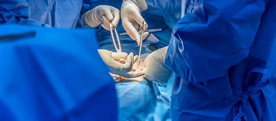 Doctor or surgeon did surgery of hernia mesh repair operation in