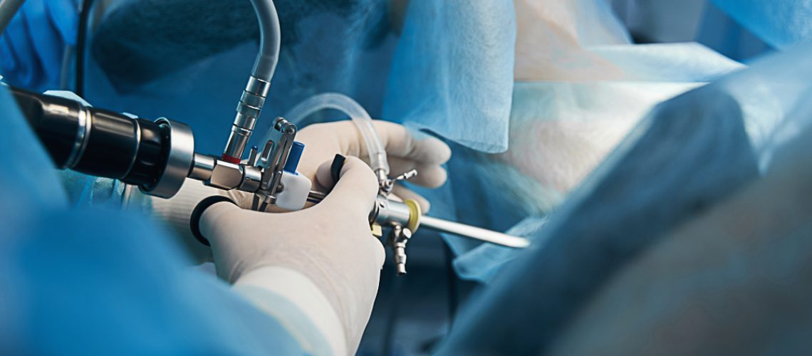 Close up photo of a medical worker in latex gloves standing with a hysteroscope near the patient