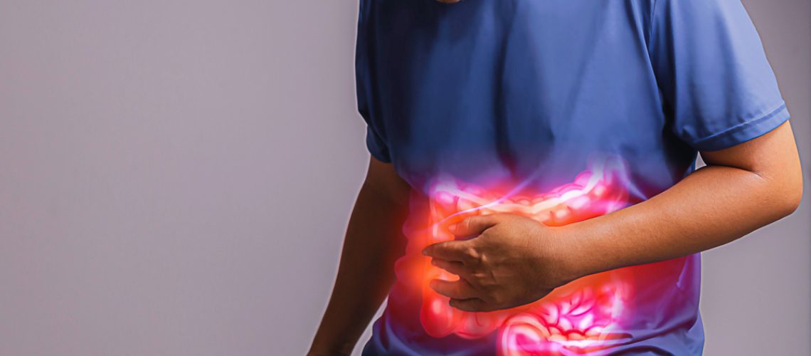 Irritable Bowel Syndrome (IBS)., x-ray concept.