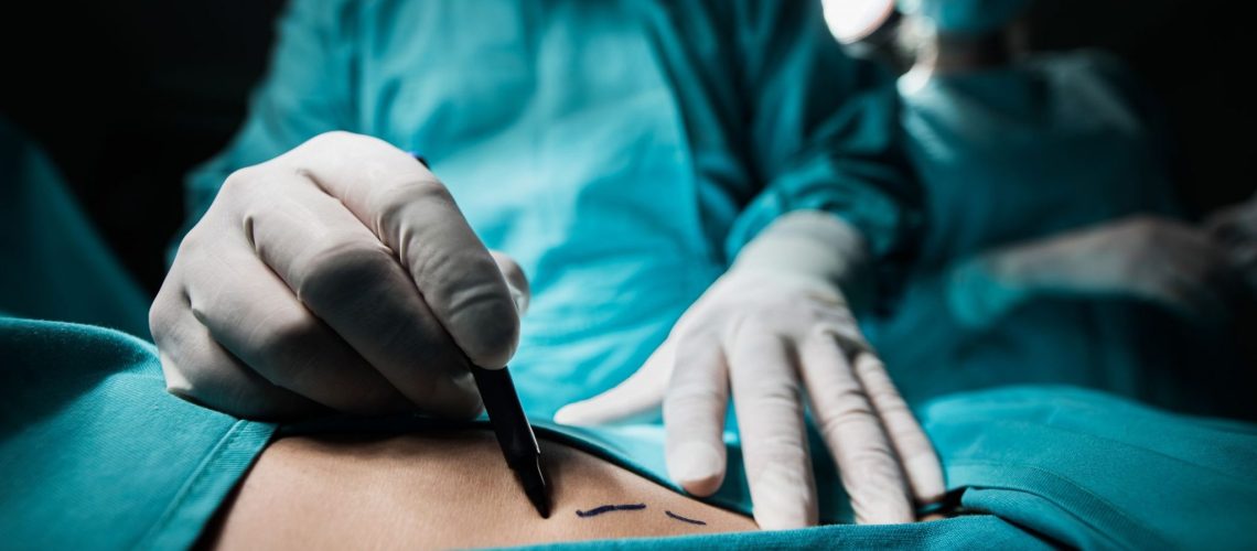 cirurgia bariátrica