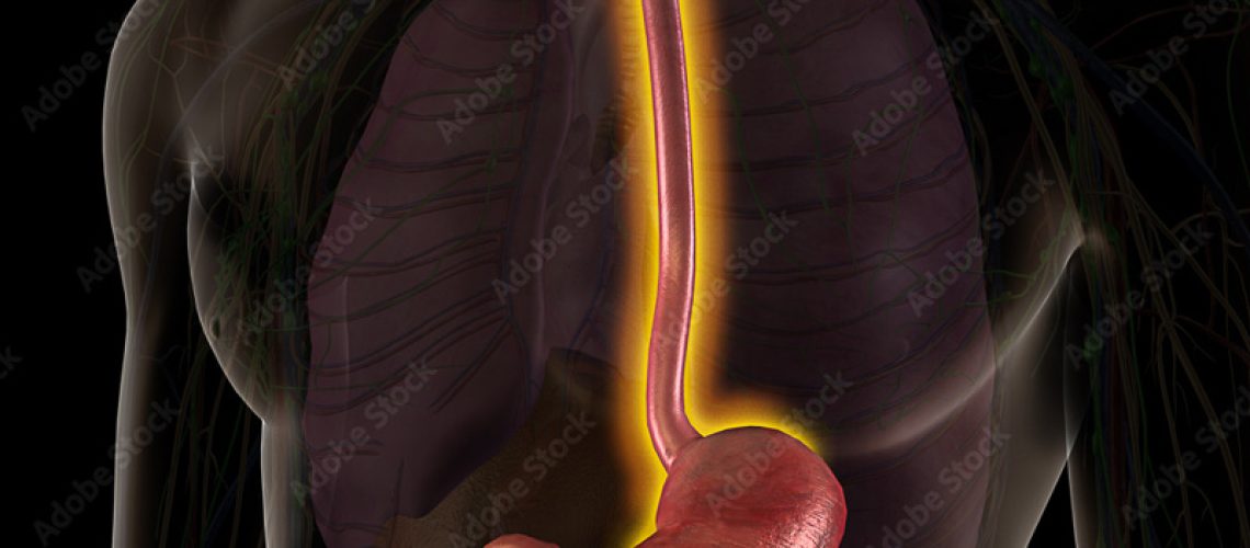 esofagite-o-que-é-e-quais-seus-tratamentos