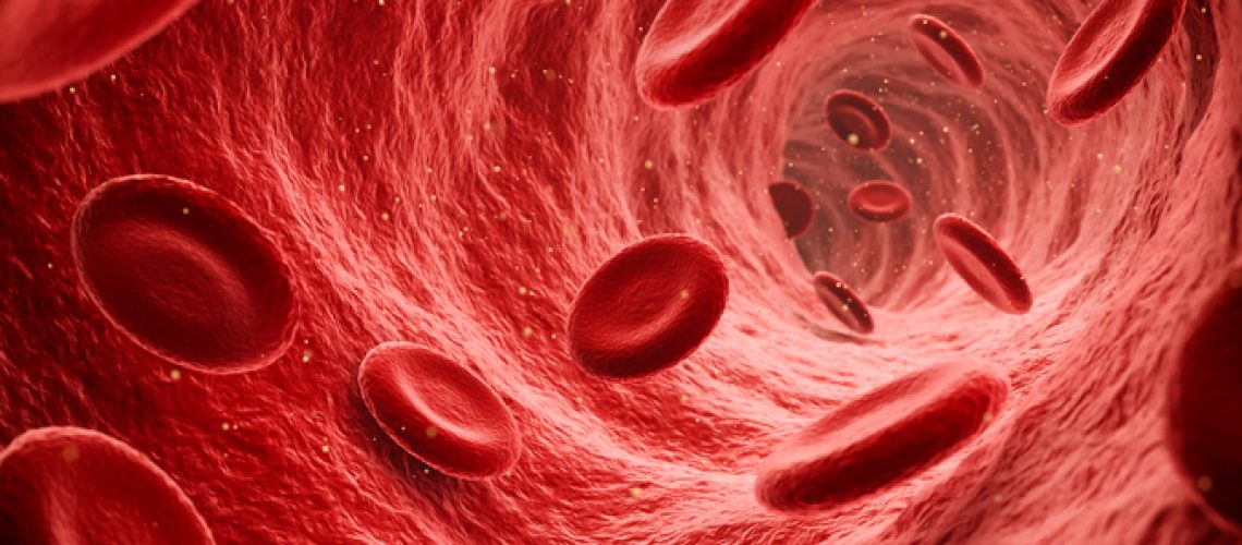 Trombose mesentérica