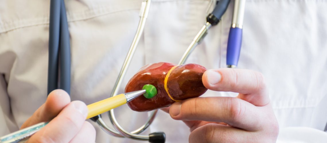 câncer de vesícula biliar