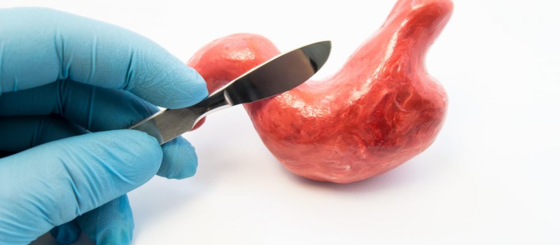 cirurgia bariátrica