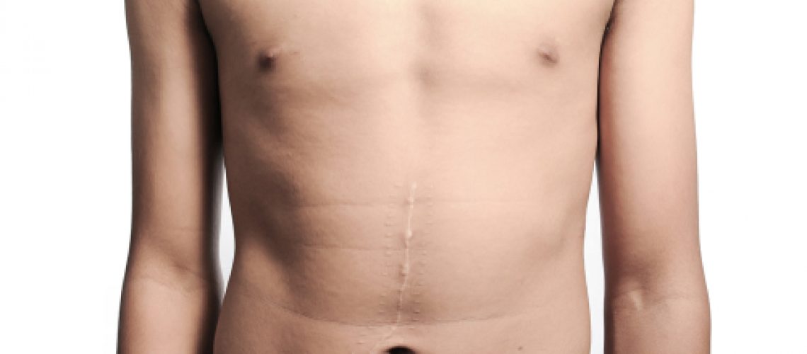 Cirurgia abdominal e hérnias