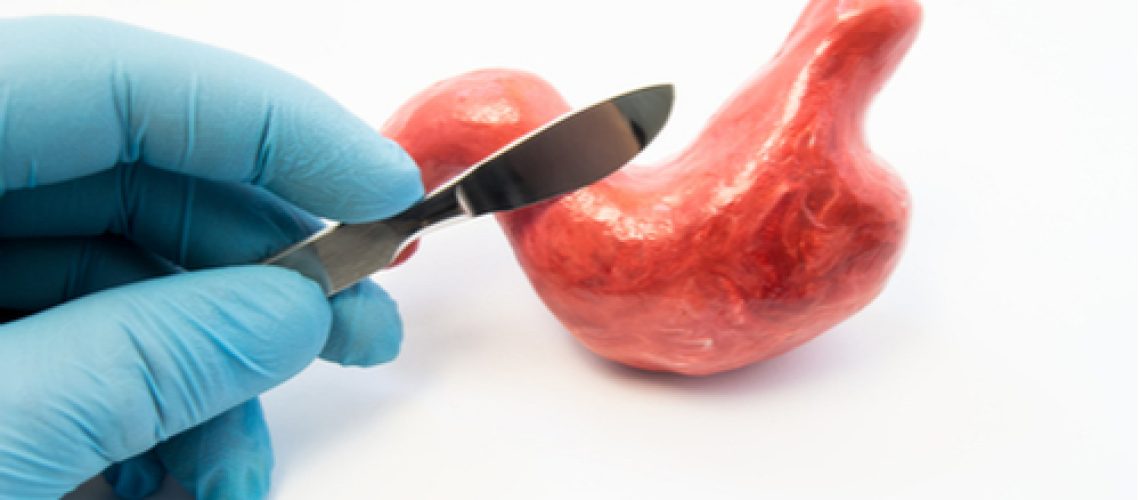 cirurgia bariátrica